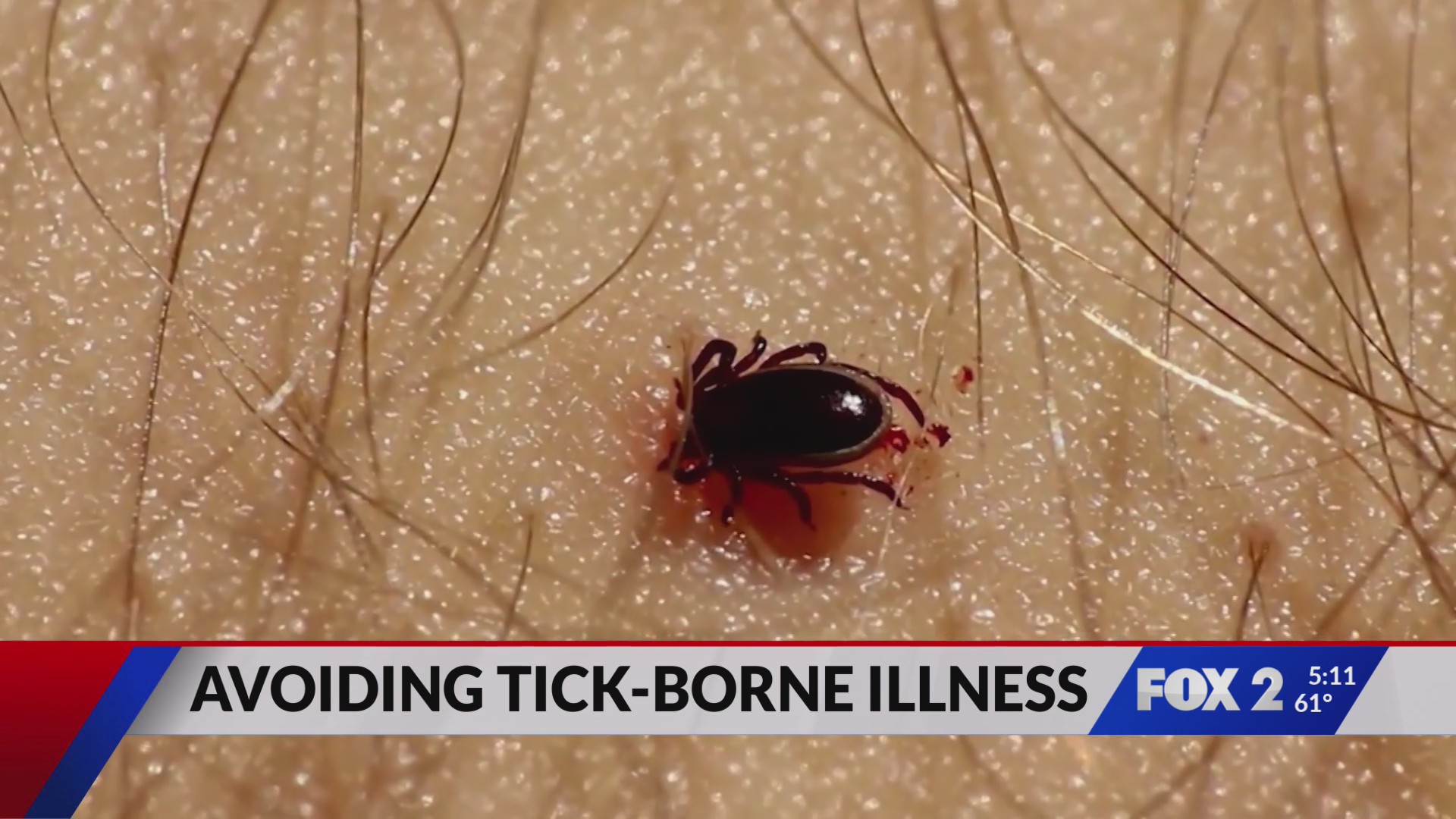 Fox File Tick Tick season seems to be off to a fast start, and some experts worry ...