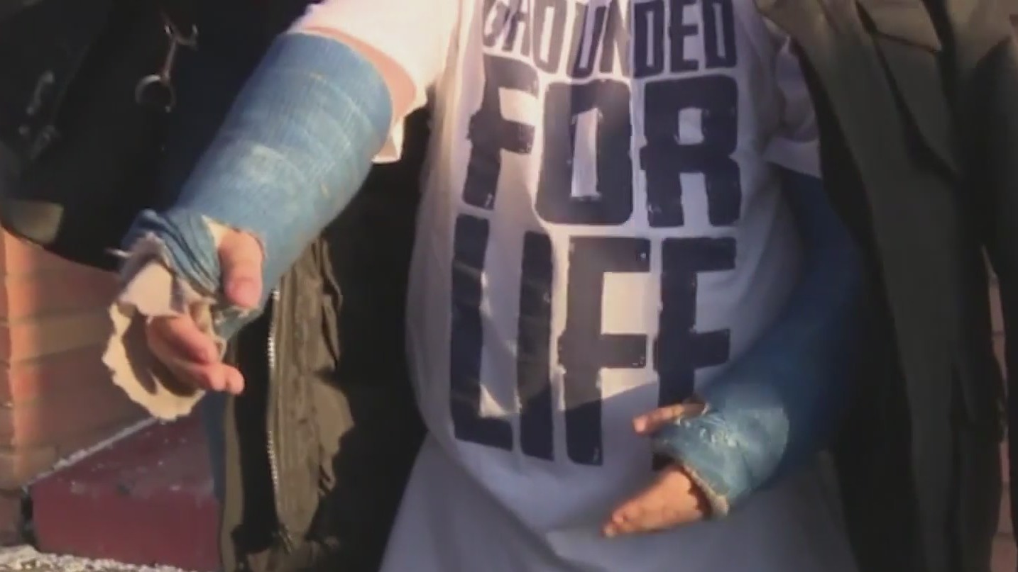 Exclusive: City is long overdue paying settlement to boy who broke both ...