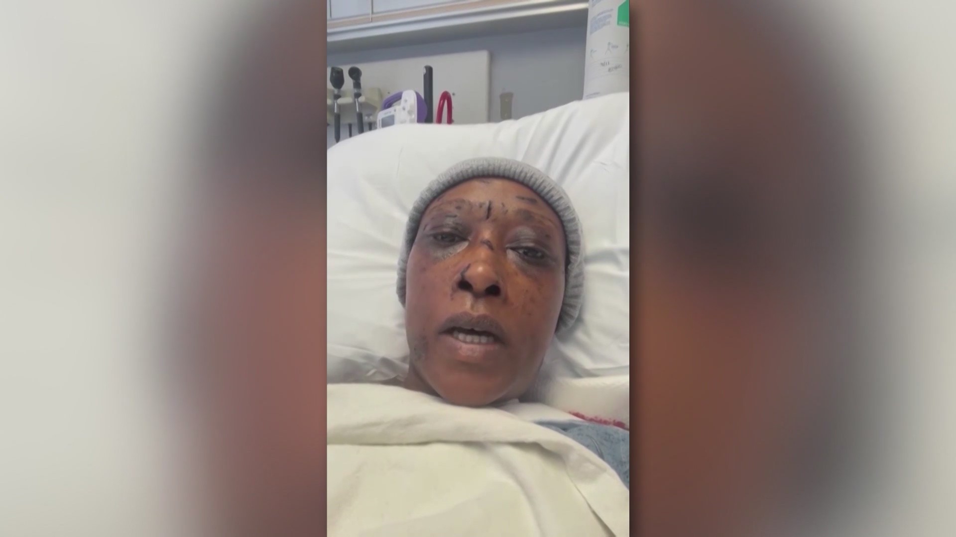 Woman dies weeks after deadly dog attack – WREG.com