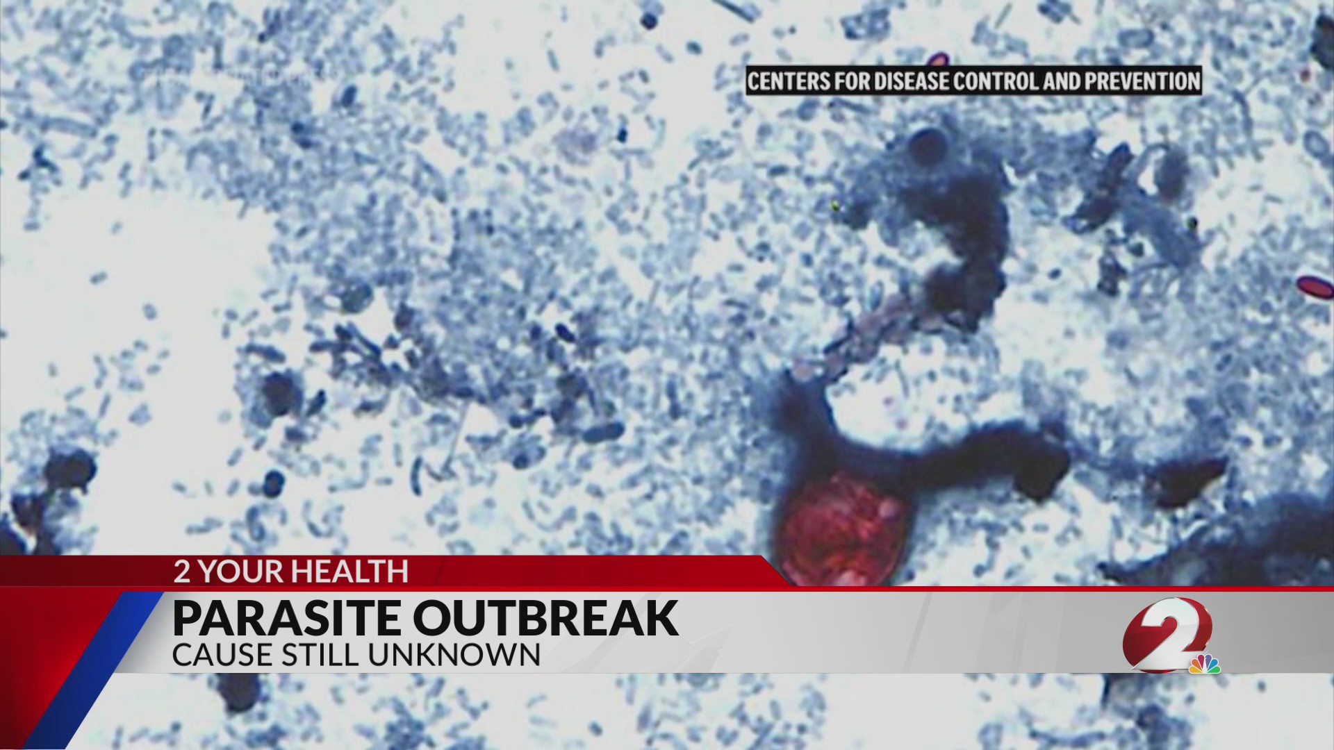Dayton residents, health experts still unsure of risk posed by parasite outbreak