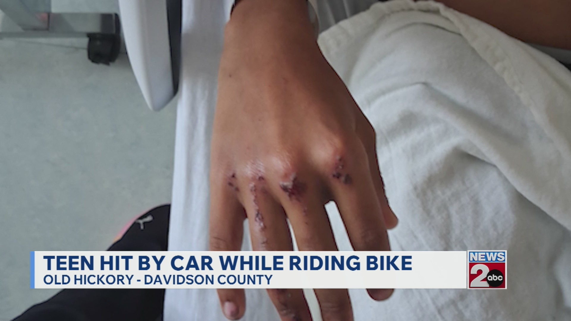 Teen hit by car while riding bike in Old Hickory – WKRN News 2