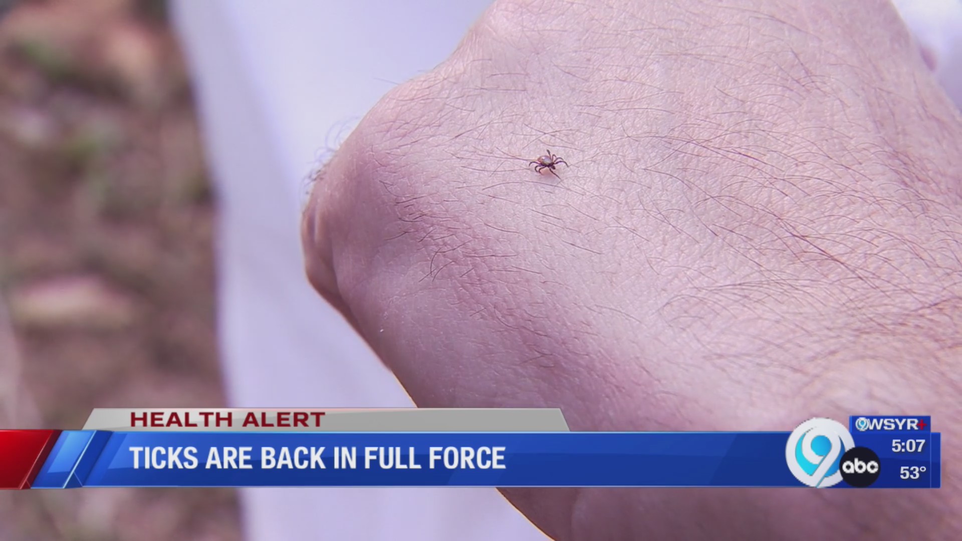 Ticks are back amid warmer weather in Central New York – WSYR