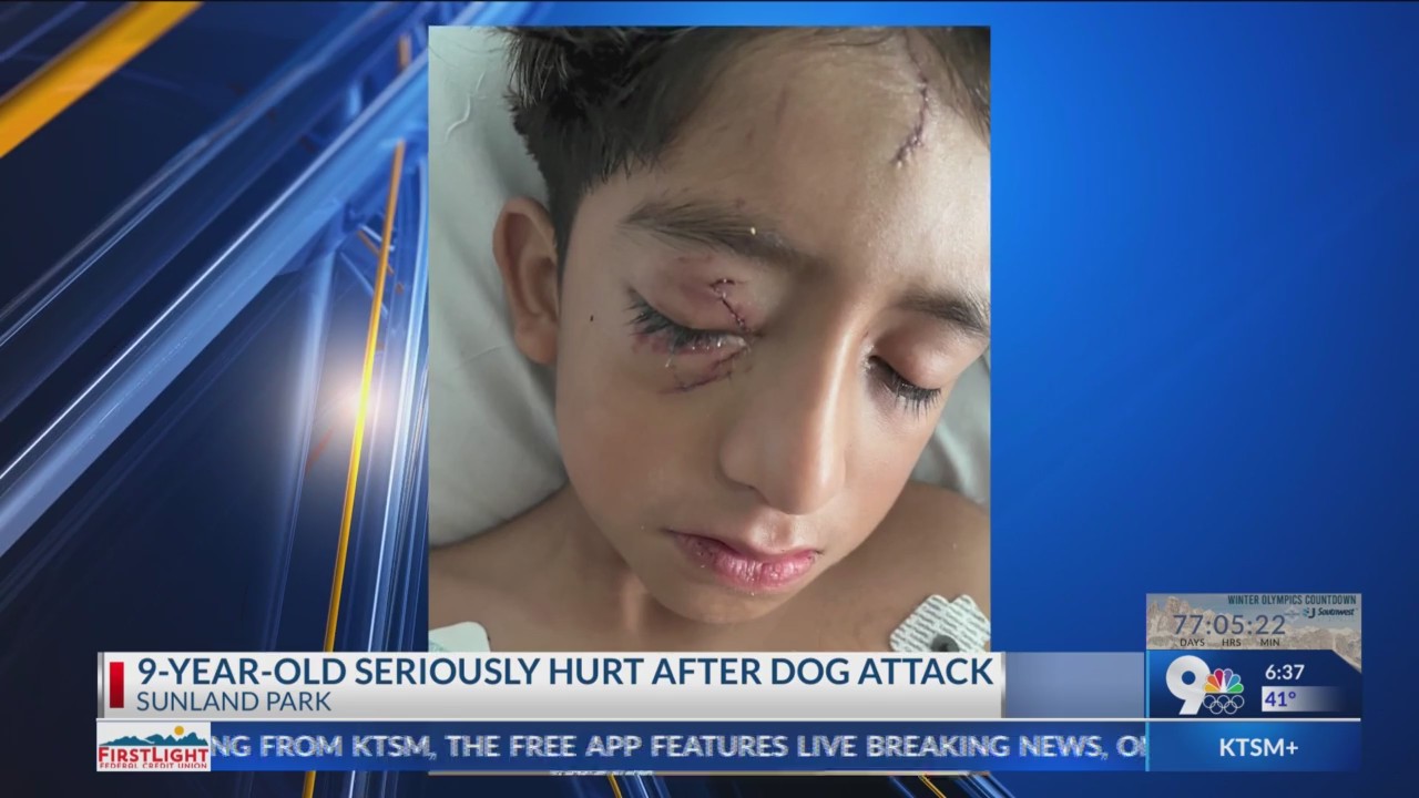 9-year-old seriously injured after dog attack – KTSM 9 News
