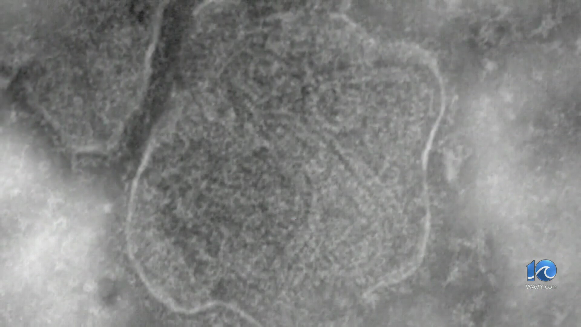 Pennsylvania measles cases pass 1K mark amid outbreak – WAVY.com