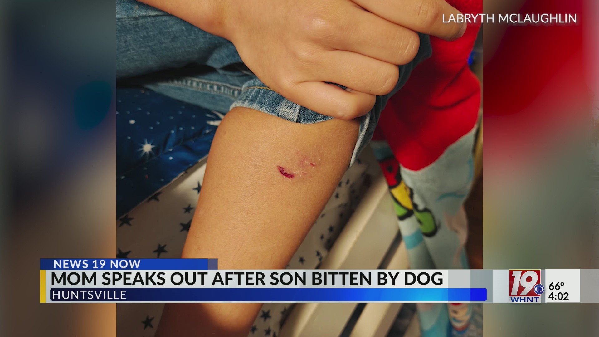 Mom Speaks Out After Son Bitten By Dog | Nov. 20, 2025 | News 19 at 4 p ...