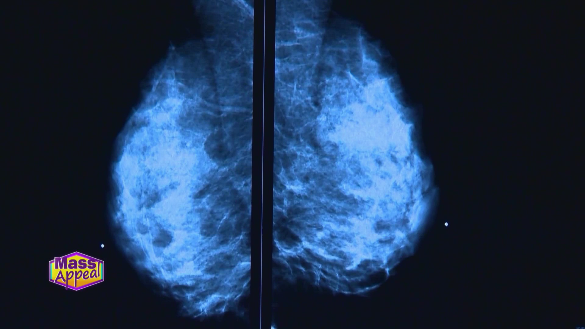Mass Appeal Breast Cancer Awareness Month – WWLP
