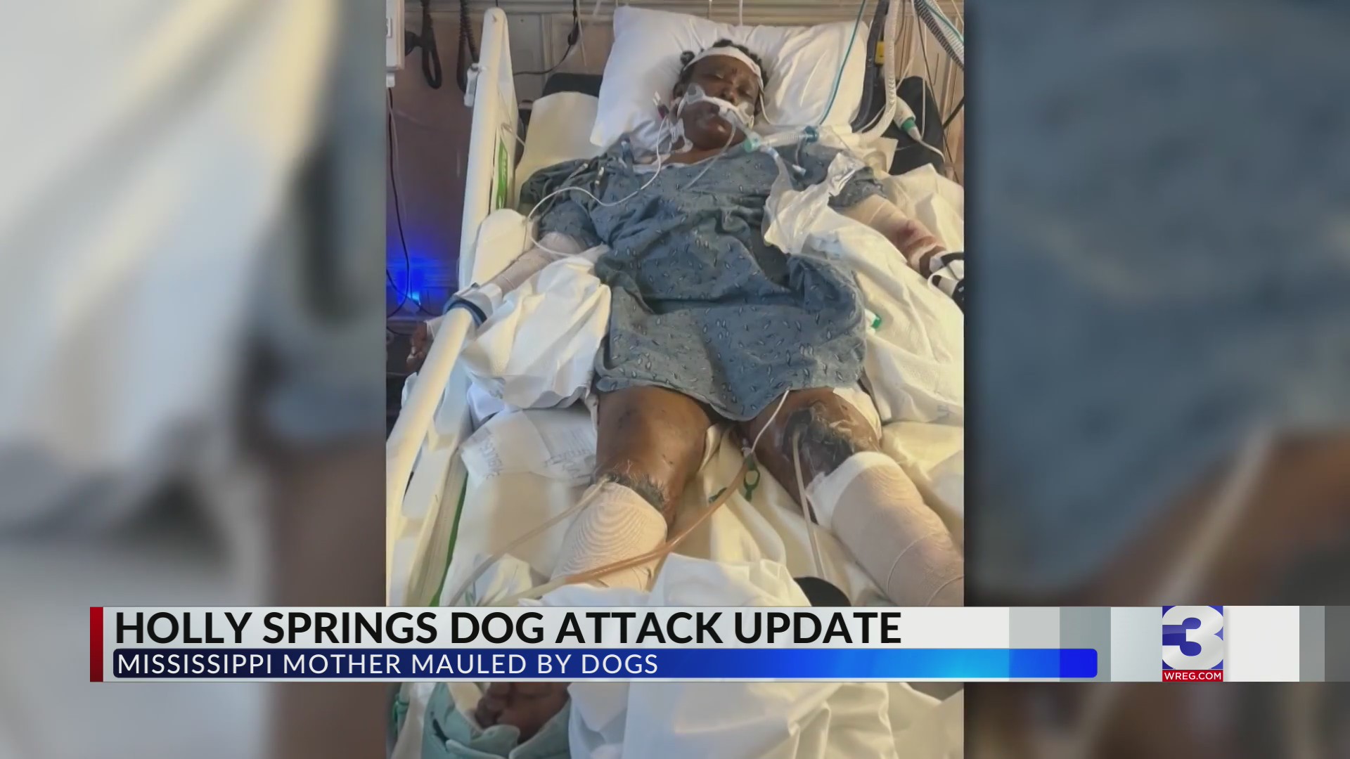 Police chief questions wounds on MS woman mauled by dogs – WREG.com