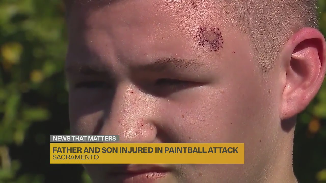 Father, son hit by paintball attack while waiting for bus in Sacramento ...