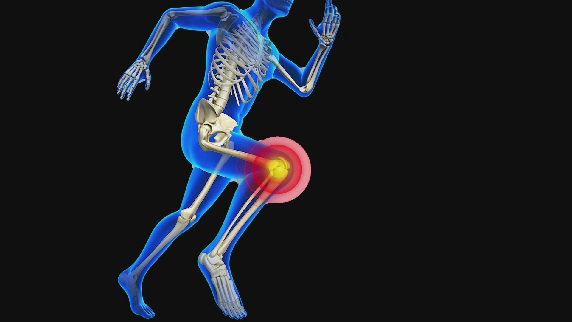 Green Bay medical expert explains ACL tears and how it can be prevented ...